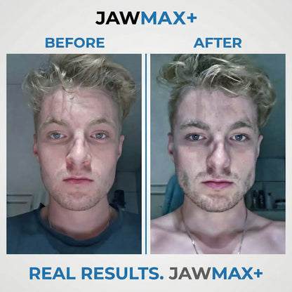The JAWMAX+ 6-Piece Pack